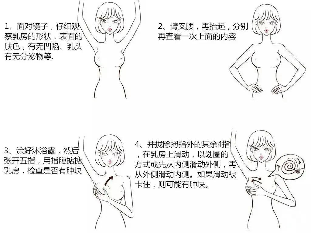 乳癌防治日_自检手法不对？三招识别省万元医疗费
