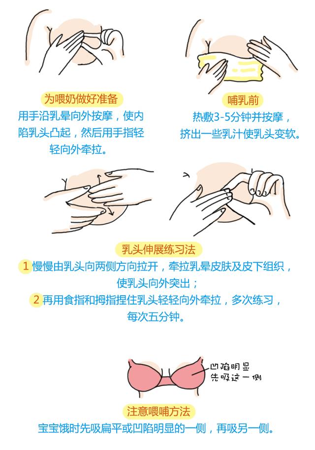 宝贝你的奶头好紧好大怎么办_哺乳期硬结处理指南_新手妈妈必看攻略