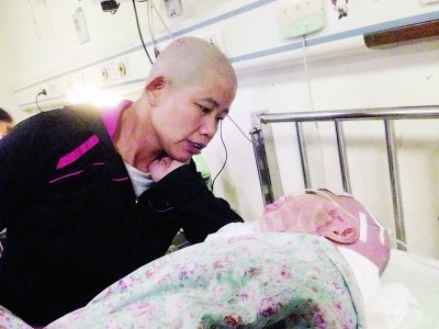 重度烧伤时家人能为你剃光头捐头皮吗？