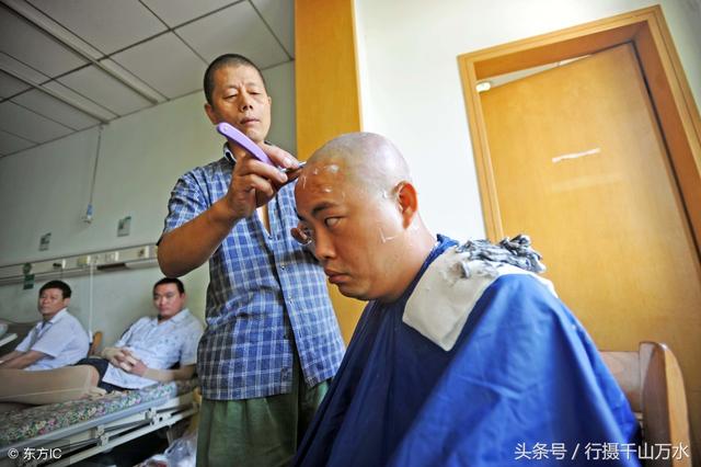 重度烧伤时家人能为你剃光头捐头皮吗？