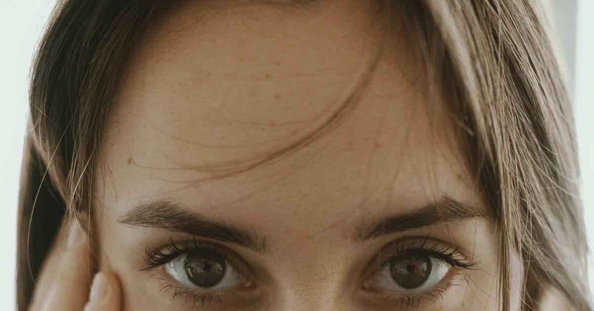 印堂长痘真的是运势不好吗？