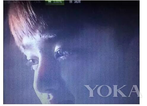 塌鼻子真的只能靠整容才能救吗？