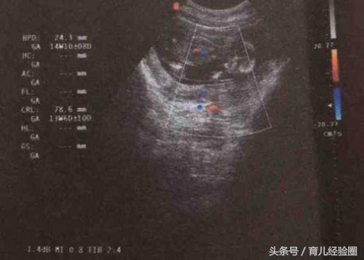 梦见大便到底意味着什么？