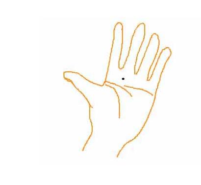 人中有痣是福气还是隐患？