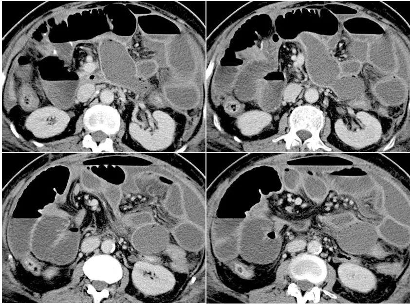 为什么总有人把 肠 读成chǎng？