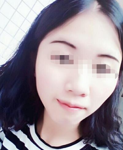 痣长在哪里才算好命？