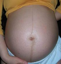 生男生女真的能靠症状猜出来吗？