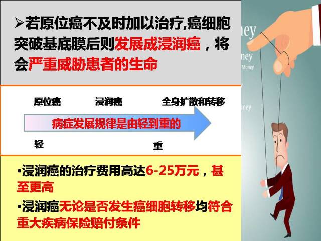 保险不保原位癌的原因是什么?有官方解释吗?干货! 保险不保原位癌的原因是什么?有官方解释吗?干货!