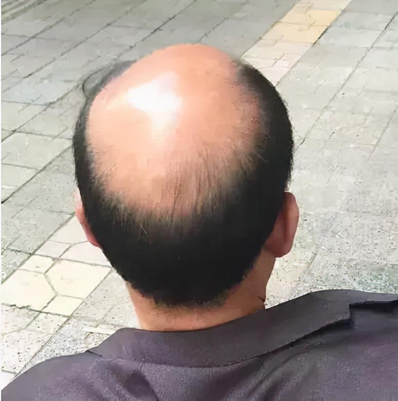 为什么别人玩辅助能carry全场，你却只能当移动眼位？