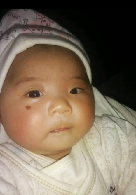 眼皮上的胎记藏着什么人生密码？