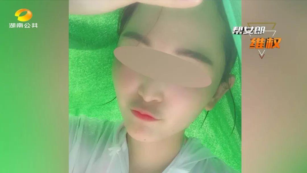 塌鼻子逆袭高鼻梁真的不用动刀吗？