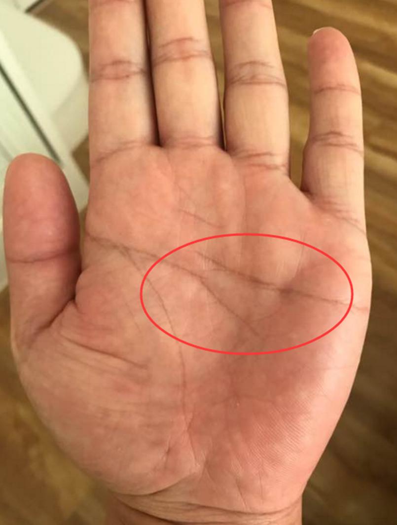 手掌上的纹路真能预测人生？