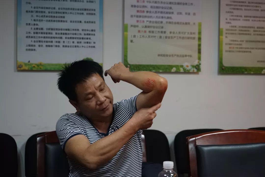 法医鉴定轻微伤到底怎么判断？