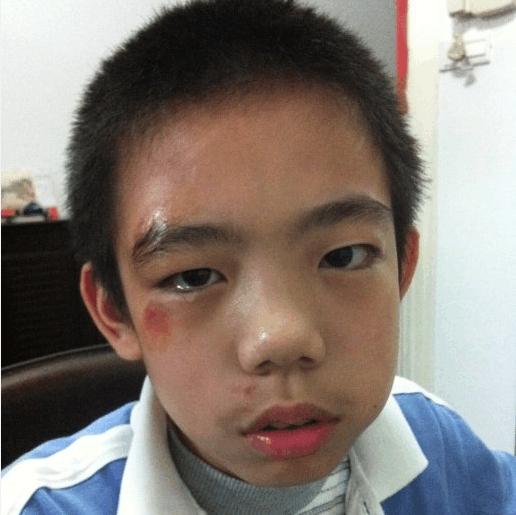 猫咪眼睛有血丝是生病了吗？