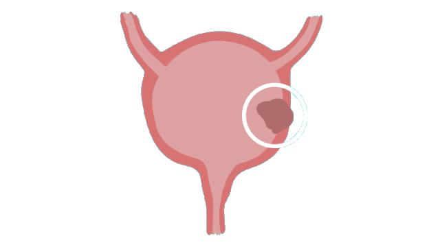 猫咪尿血直接喂人用消炎药会要命? 猫咪尿血直接喂人用消炎药会要命?