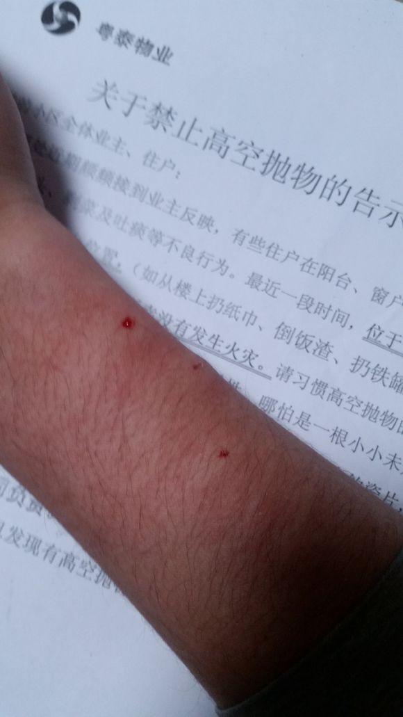 猫咪突然咬人是讨厌我吗? 猫咪突然咬人是讨厌我吗?