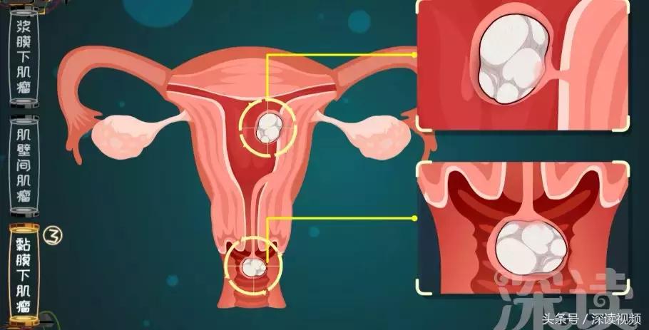 但尼丁华人论坛到底怎么用才不踩坑？