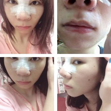 猫咪太瘦怎么办？三个步骤养出圆滚滚主子