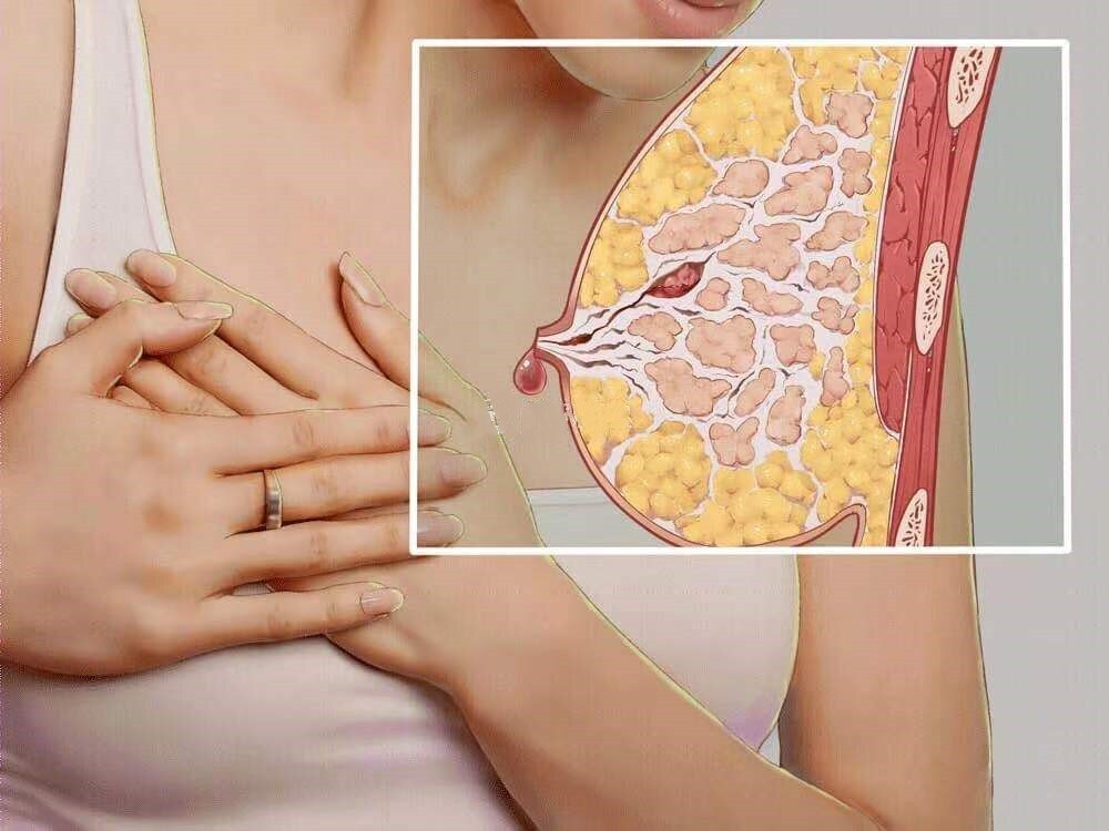 梦见乳房有脓水要警惕什么？2025年运势解析与化解指南