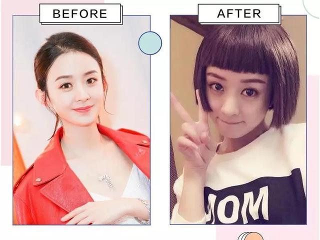 明星植发真的能救回发际线吗? 明星植发真的能救回发际线吗?