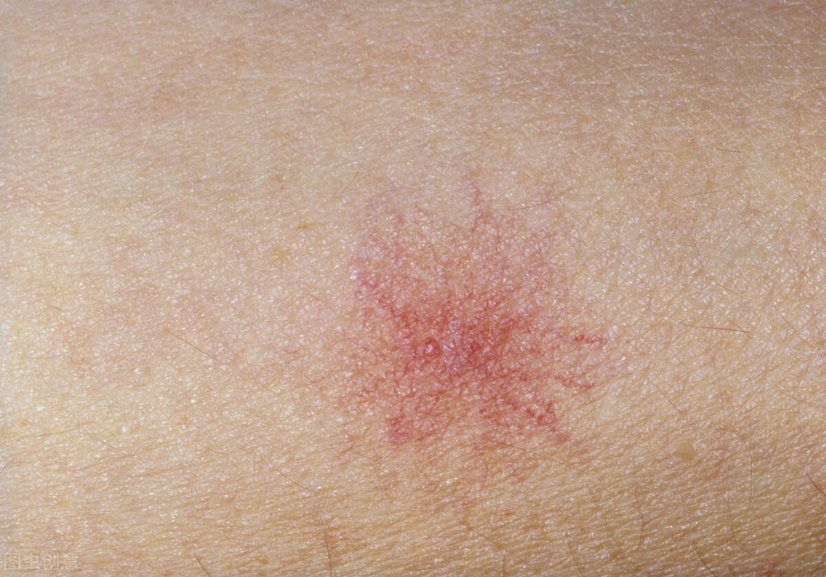 为什么BL作品里的 受 总被设定成猫咪性格？