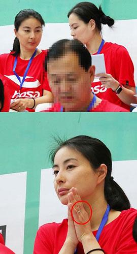 女人梦见下巴长痣预示什么？警惕这三大隐藏预兆