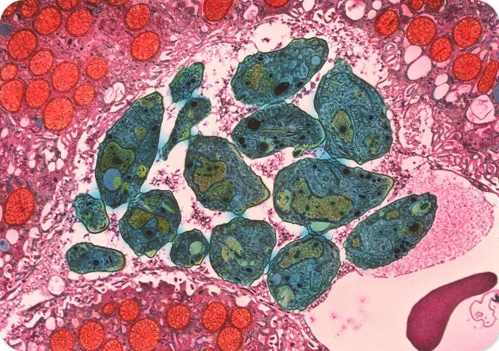 猫咪感染弓形虫会传染给人吗? 猫咪感染弓形虫会传染给人吗?