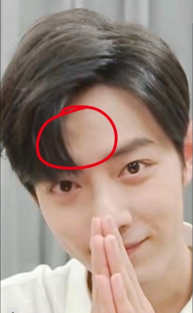 女人梦见下巴长痣预示什么？警惕这三大隐藏预兆