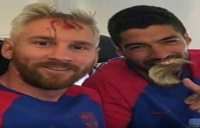 长得像梅西被路人追着拍照怎么办？