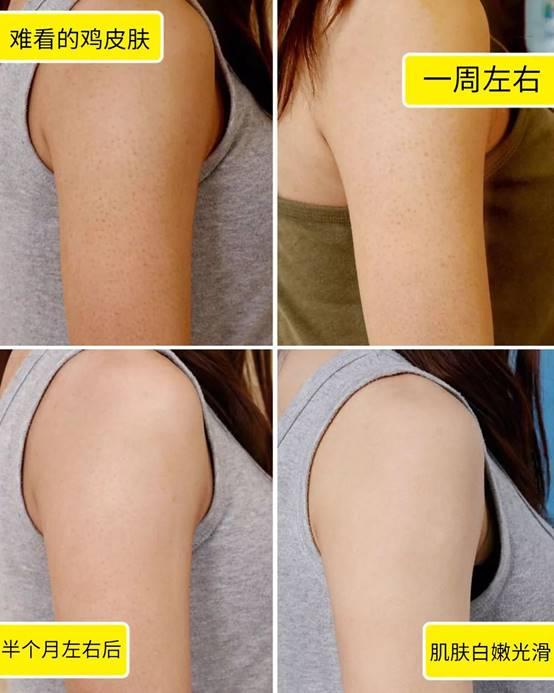 南非世界杯哪个进球让你现在想起来还起鸡皮疙瘩？