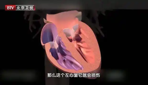 人为什么会做梦_梦境与大脑区域的关系_做梦梦到梦中梦中梦是什么意思