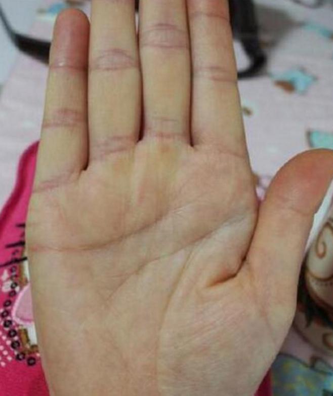 男人手掌纹路真的能预测命运吗？