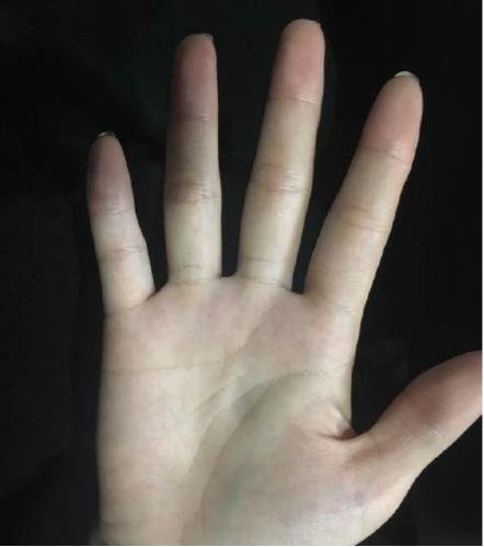 手掌上的纹路真能预测人生？