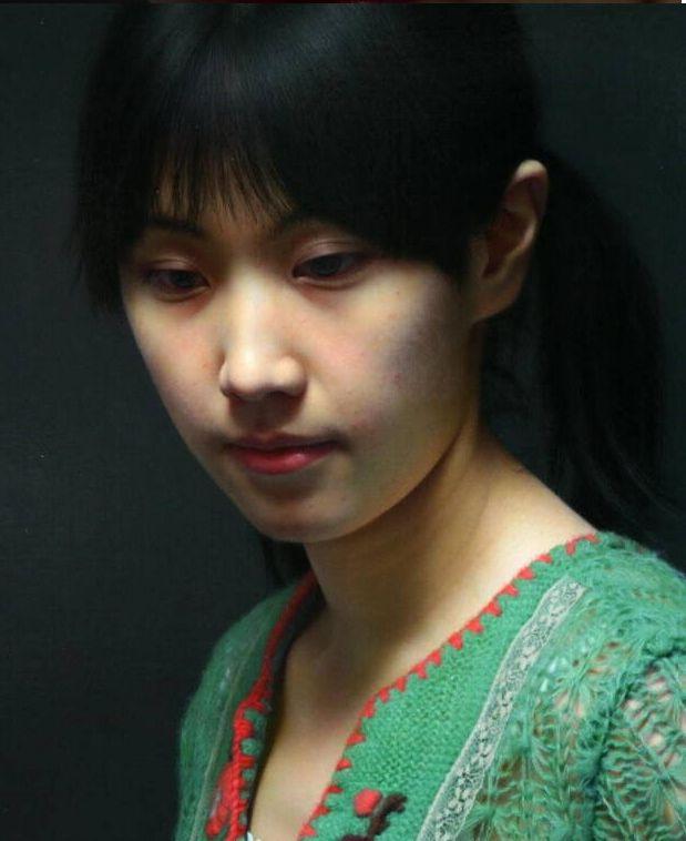 手上长痣到底要不要紧？这7个真相你必须知道！