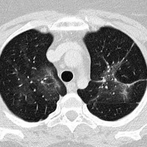 2025年做梦梦见例假预示什么？心理与运势全解