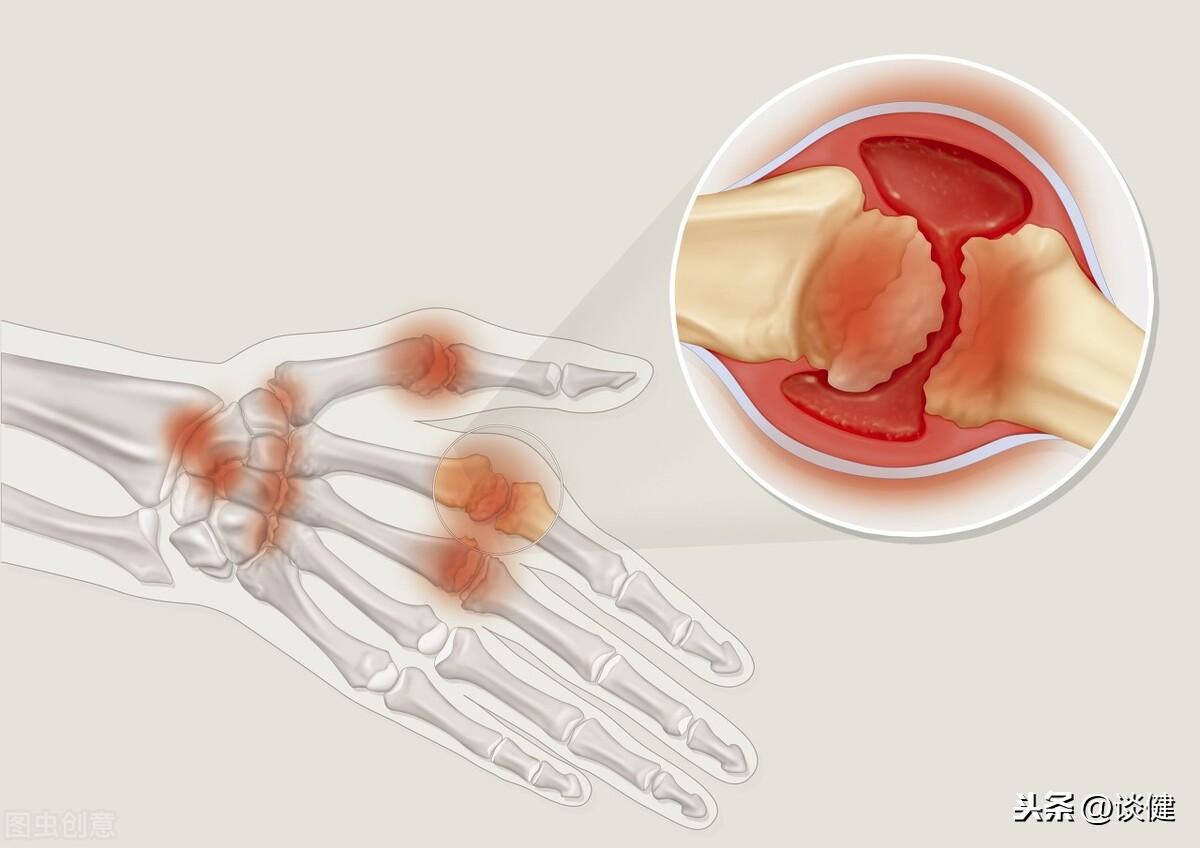 每天打字打到手抽筋？你可能得了 倦拼音 ！