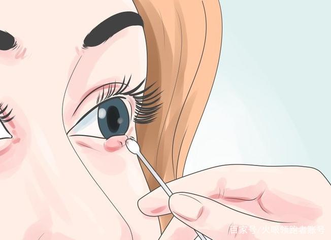 睫毛胶水涂完第二天就发痒？