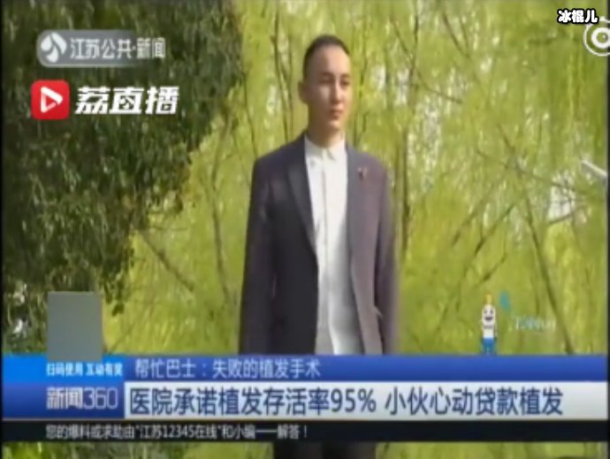 贷款25000元种了2500根头发