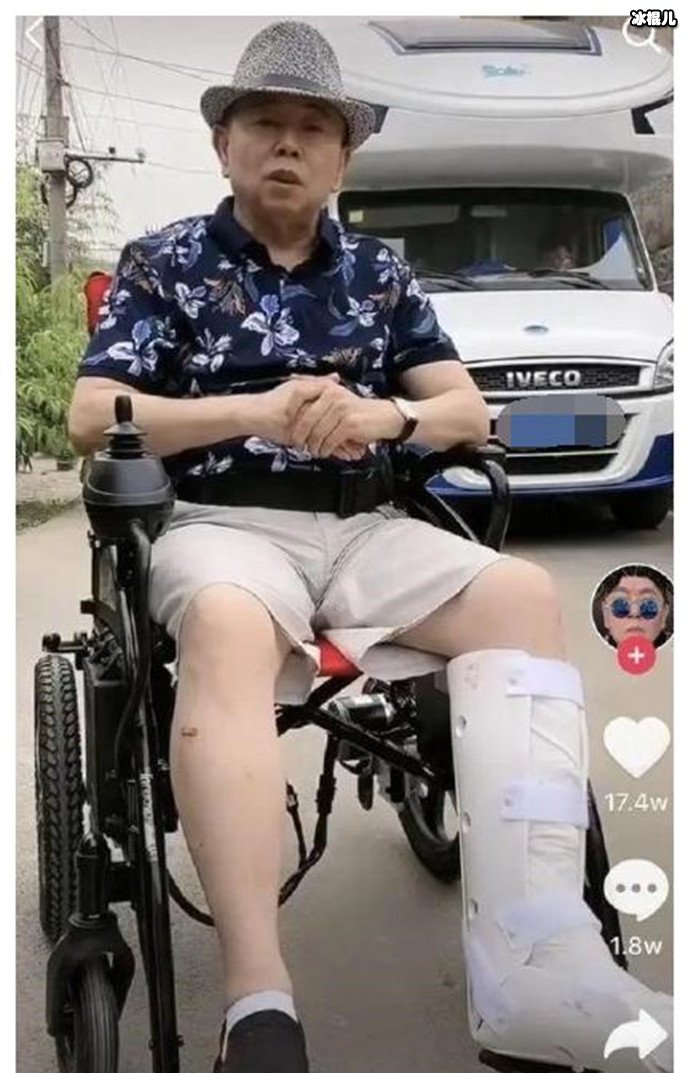 潘长江因拍戏左脚骨折