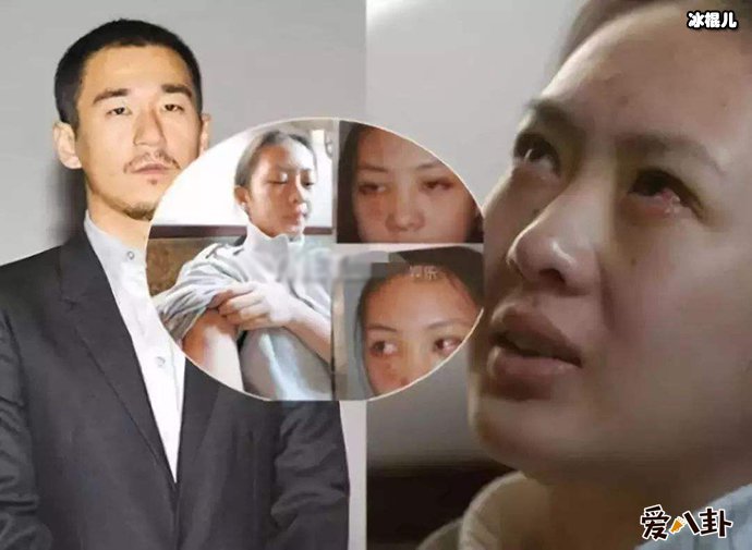 张默为什么怒打女友童瑶如今真相了