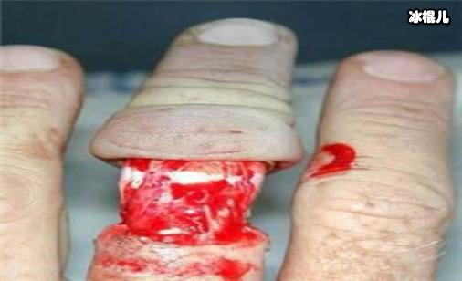 戴戒指打保龄球