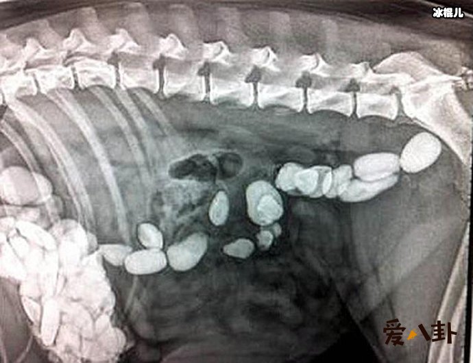 还检查出其他东西让医生崩溃