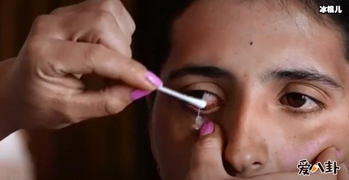女子眼睛竟流出“钻石”