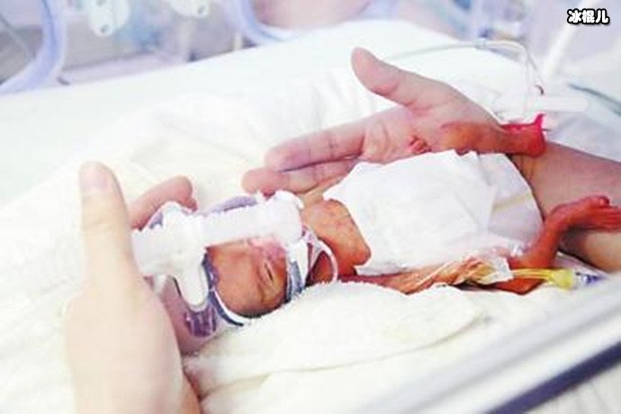 巴掌宝宝出生