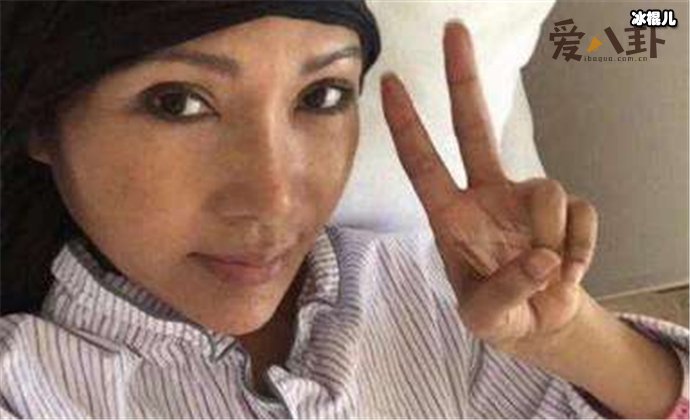 张咪po患病后的照片