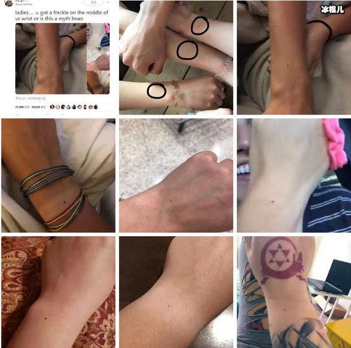 国外网友晒手臂上的痣