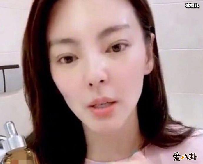 张雨绮疑似整容失败