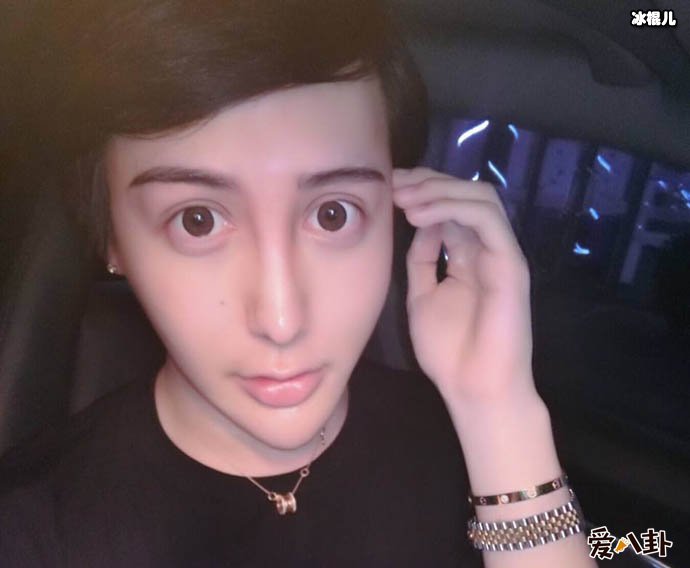 蛇精男刘梓晨现况如何