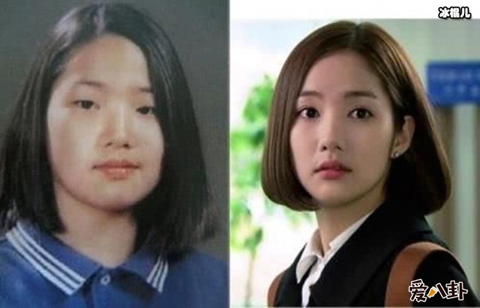 朴敏英整容前后对比照