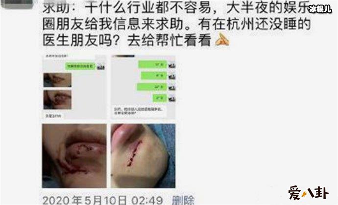 网曝范丞丞洗澡摔倒